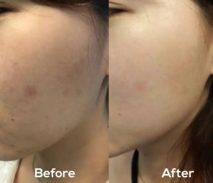 Axis-Y - Dark Spot Correcting Glow serum 50ml Axis-Y