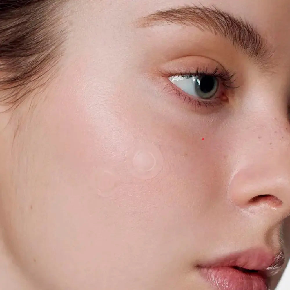 Some By Mi - Micro Pin Spot Patch 9pcs Some By Mi