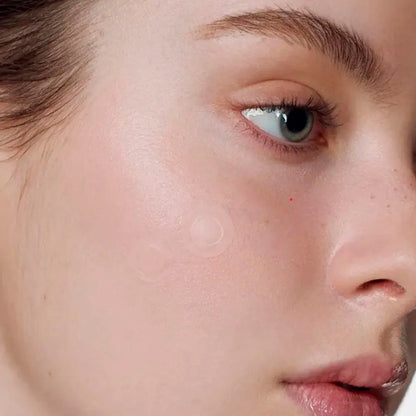 Some By Mi - Micro Pin Spot Patch 9pcs Some By Mi