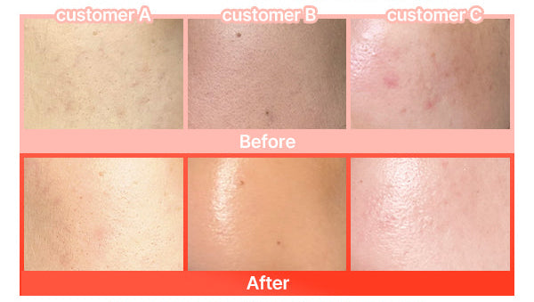 Medi-Peel - Phyto Exosome PDRN Lifting Shot Serum 50ml