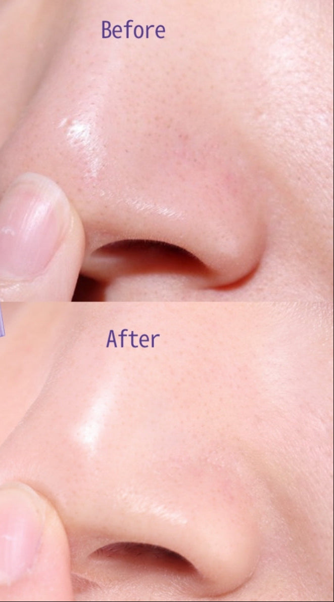 Before and after comparison of a facial product application on skin.