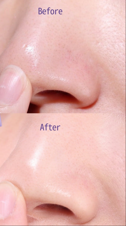 Before and after comparison of a facial product application on skin.